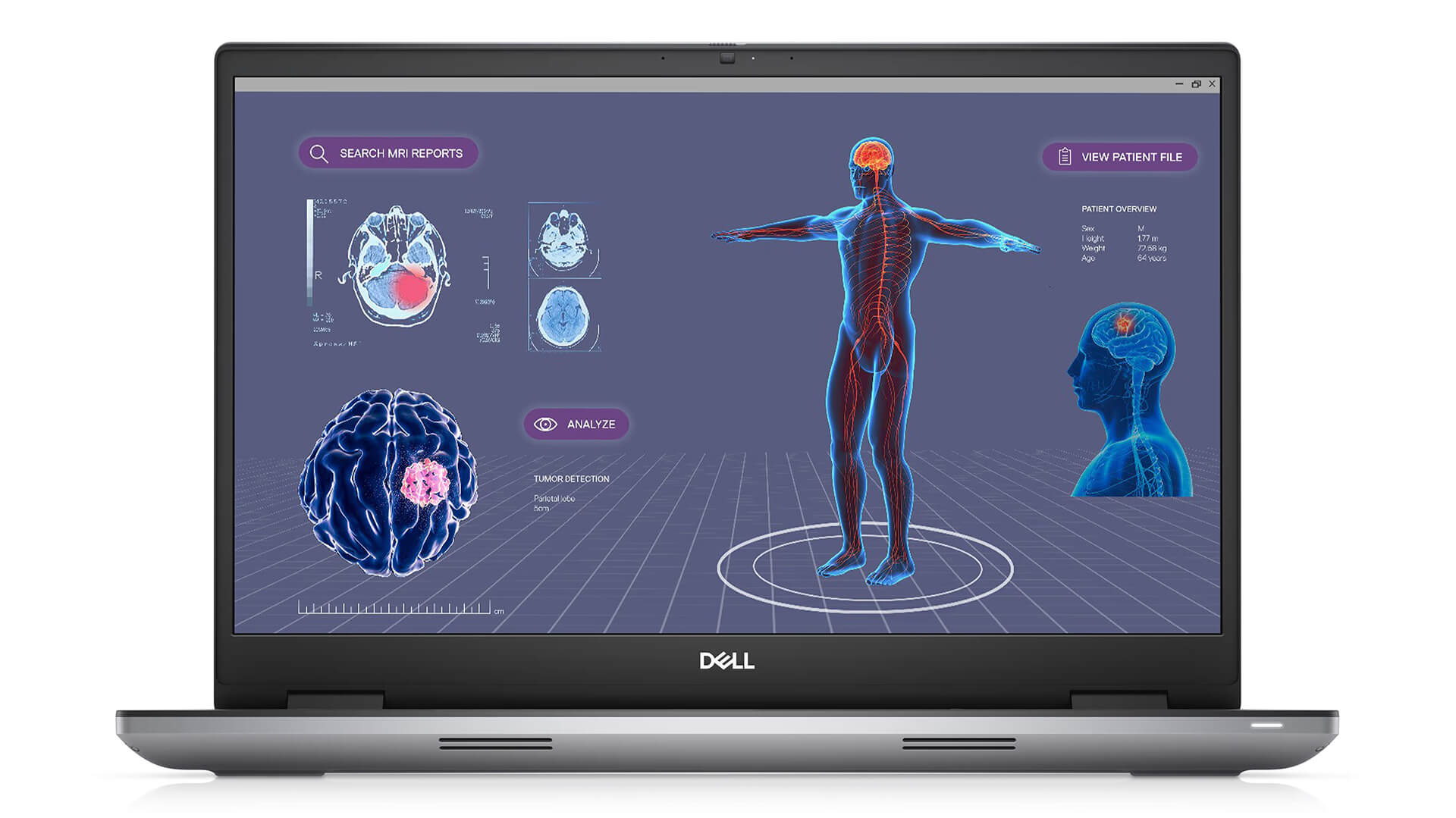 Đánh Giá Dell Precision 7780 Workstation Hoàn Hảo Cho Chuyên Gia 02
