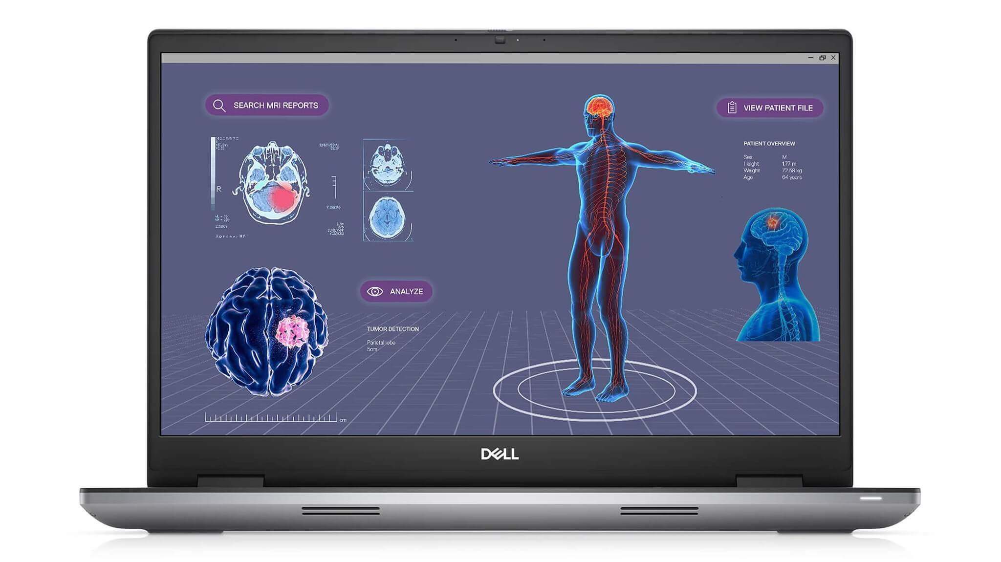 Màn hình 17.3 inch DELL Precision 7780 hiển thị phần mềm CAD kỹ thuật với độ chính xác màu 99% DCI-P3